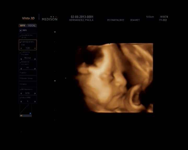 Alicia 29 semanas