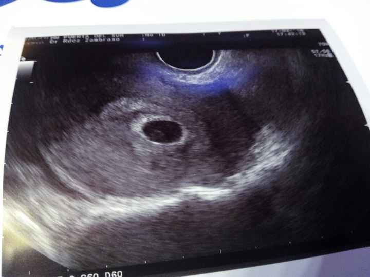 ¡futuras mamis noviembre 2016! - 1