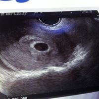 ¡futuras mamis noviembre 2016! - 1