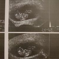 Futuras mamis Julio 2022! - 1