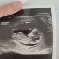 Futuras mamás agosto 2022 - 1