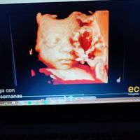 Futuras mamis Julio 2022! - 1