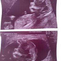 Futuras mamas septiembre 2021🤰🤱 - 1
