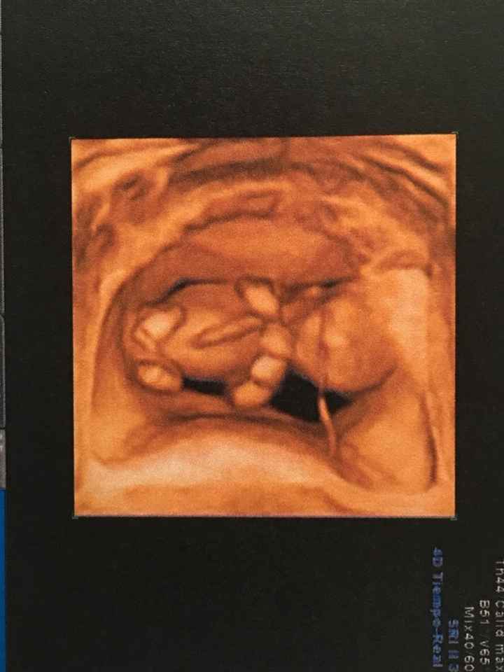 ¡¡futuras mamás agosto 2016!! - 2