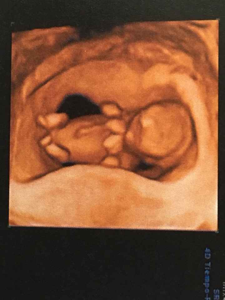 ¡¡futuras mamás agosto 2016!! - 3