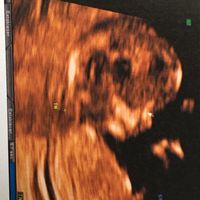 ¡¡futuras mamás agosto 2016!! - 1