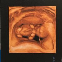 ¡¡futuras mamás agosto 2016!! - 2