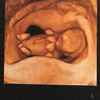 ¡¡futuras mamás agosto 2016!! - 3