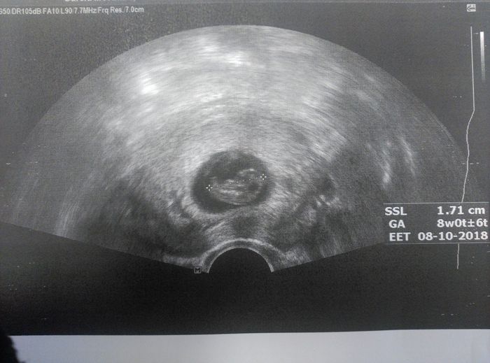 bebe 8 semanas