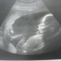 Lola con 20 semanas