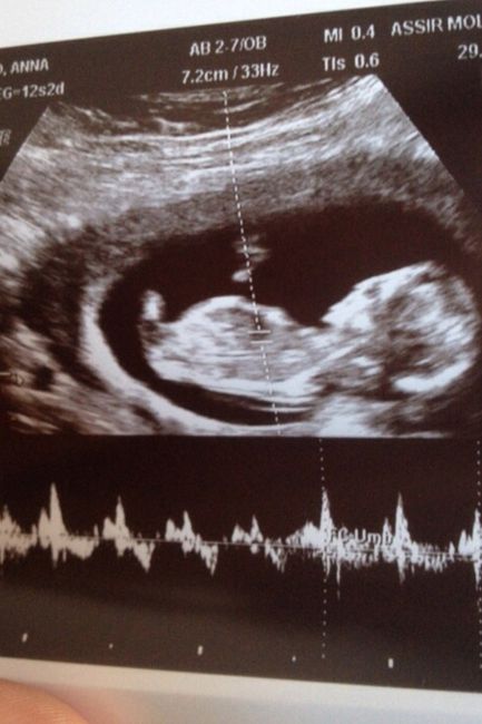 Mamas para julio 2015 :) - 2