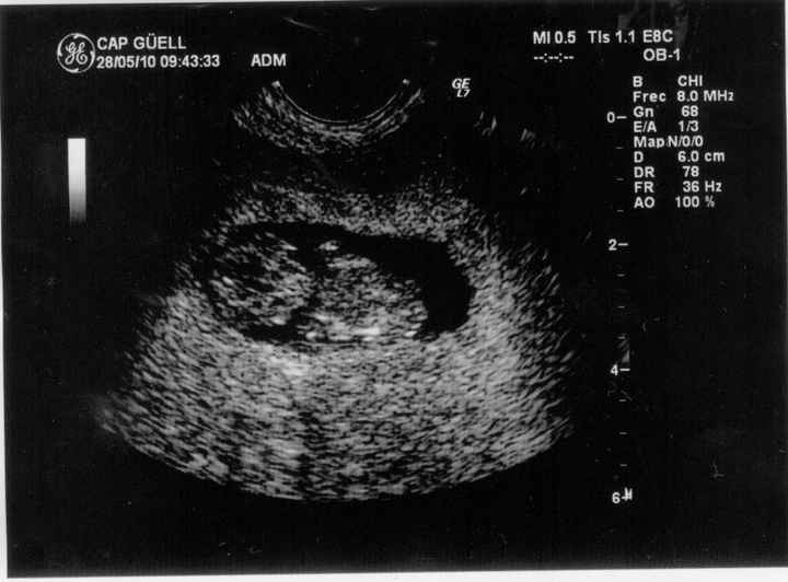NUESTRO BEBIT@