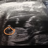 Futuras mamás Septiembre 2020 - 1