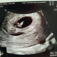 Futuras mamás Agosto 2021 - 1
