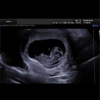 Futuras mamás Diciembre 2018 - 1