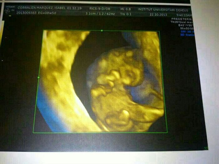 ECO DE 8 SEMANAS 3D