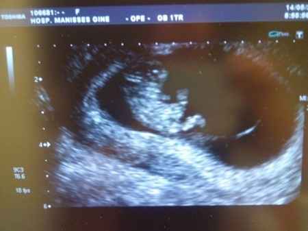 El consultorio de Lita para futuras mamis - 1