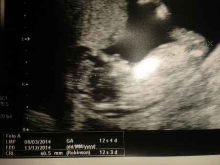 El consultorio de Lita para futuras mamis - 1