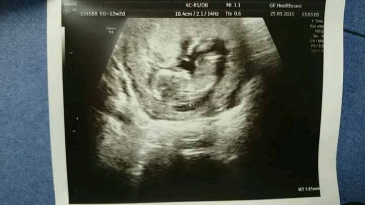 El consultorio de Lita para futuras mamis - 2