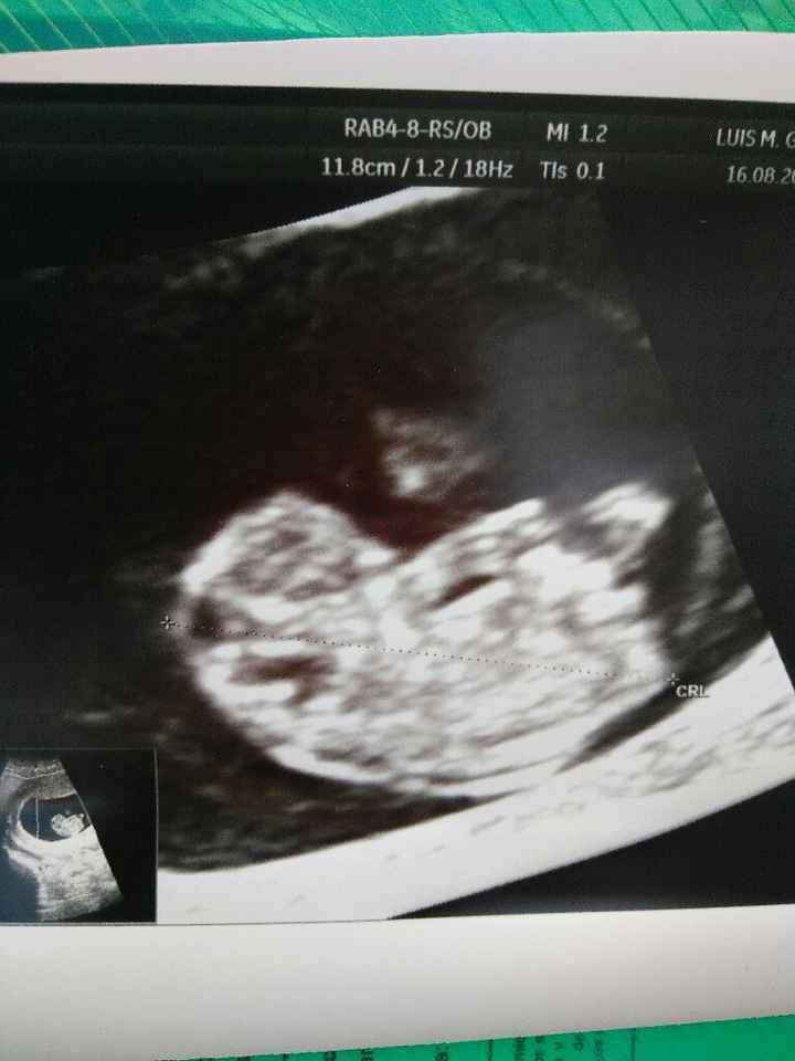 ¡nuevo! futuras mamis marzo 2018 - 1