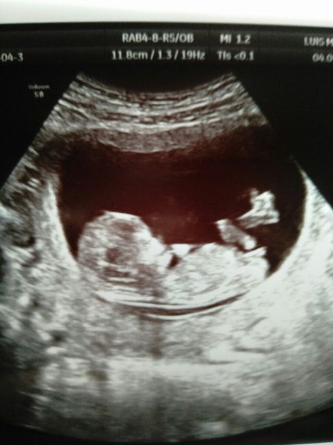 ¡nuevo! futuras mamis marzo 2018 - 1