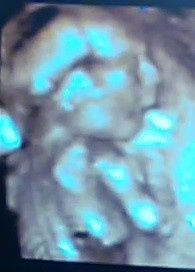 Iván 18 semanas
