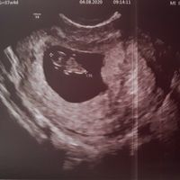 Futuras mamis Marzo 2021 ❤️❤️ - 1