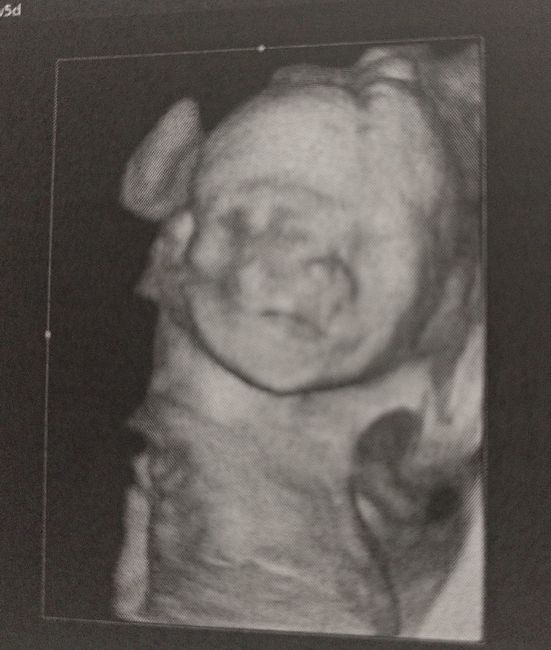 Futuras mamas octubre 2020 - 1