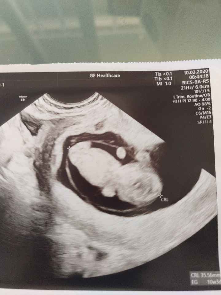 Futuras mamas octubre 2020 - 1