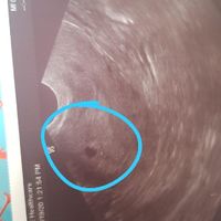 Futuras mamas octubre 2020 - 1