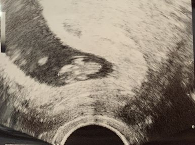 Futuras mamás Mayo 2021🤰♥️ - 2