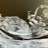 Futuras Mamis Abril 2021 - 1