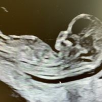Futuras Mamis Abril 2021 - 1