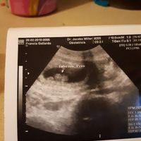 Me ayudáis niño o niña? - 1