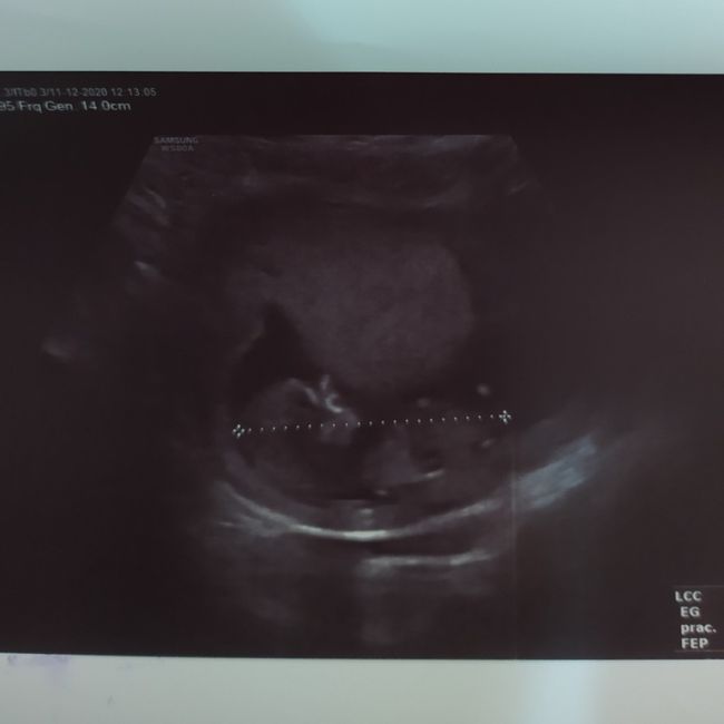 Futuras mamis junio 2021 🤰🏻❤️ oficial - 1