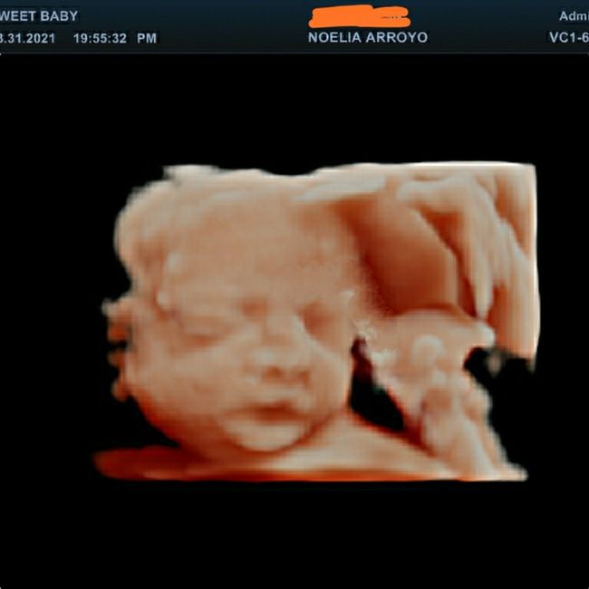 Futuras mamis junio 2021 🤰🏻❤️ oficial - 1
