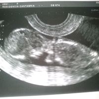 Eco 12 semanas