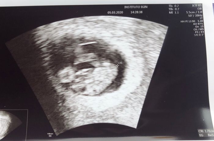 Futuras mamas octubre 2020 - 1