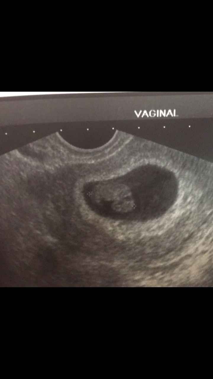  Futuras mamás Abril de 2018! - 1