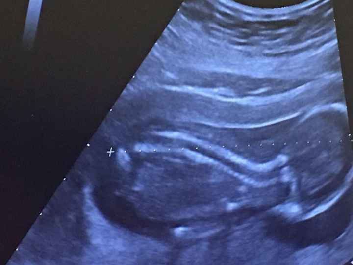  Futuras mamás Abril de 2018! - 1