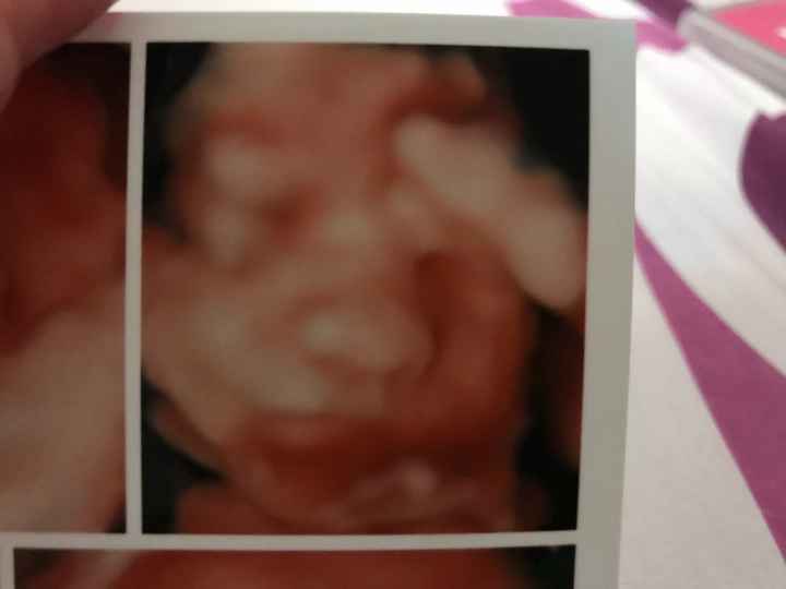  Futuras mamás Abril de 2018! - 3
