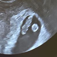 Futuras mamás agosto 2019 - 1