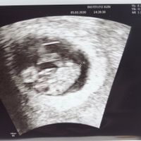 Futuras mamas octubre 2020 - 1