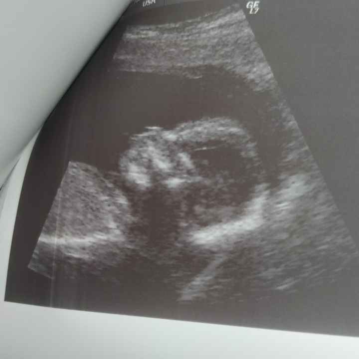 Futuras mamis junio 2021 🤰🏻❤️ oficial - 1