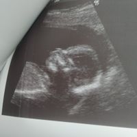 Futuras mamis junio 2021 🤰🏻❤️ oficial - 1
