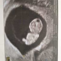 Futuras mamás diciembre 2021 ☃️ - 1