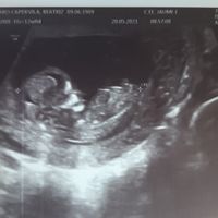 Futuras mamás diciembre 2021 ☃️ - 1