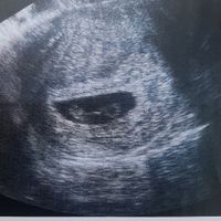Futuras mamás enero 2019 - 1