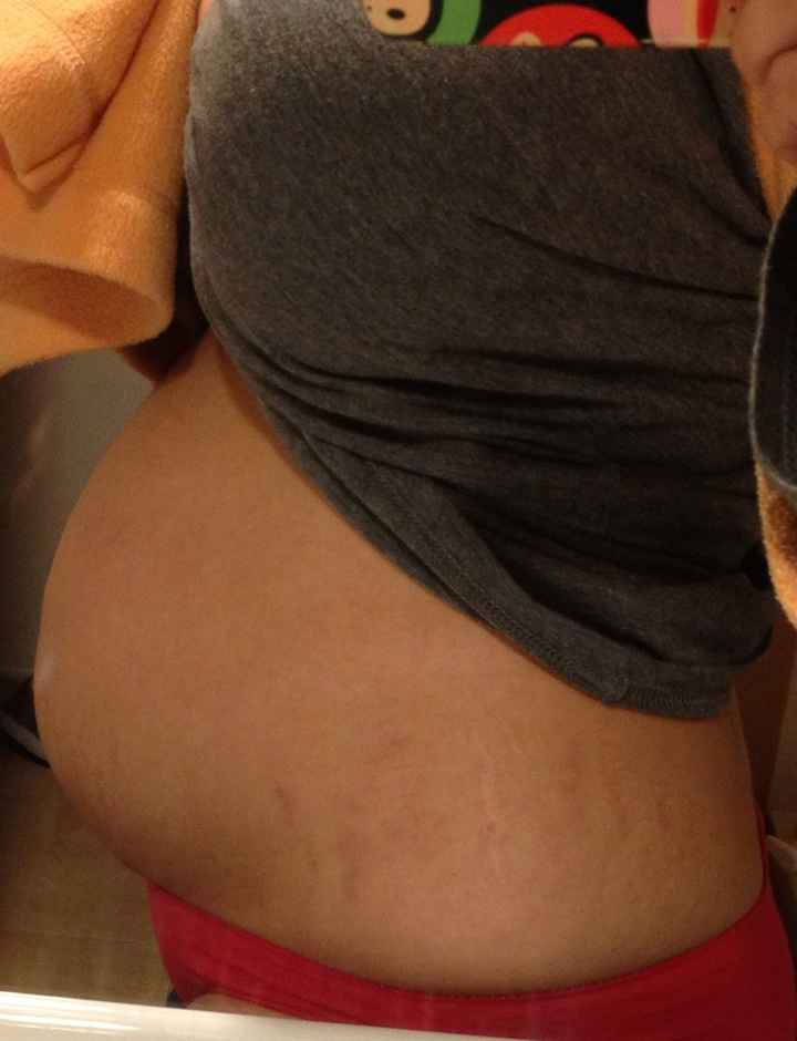 Perfil 17 semanas