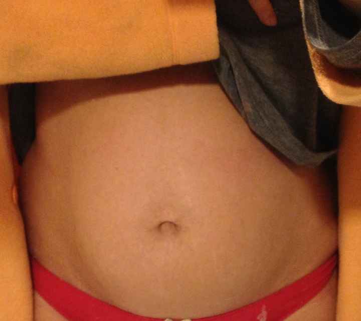 foto barriga